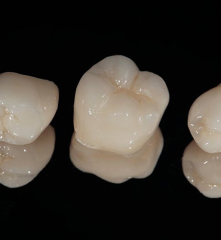 Dental crowns