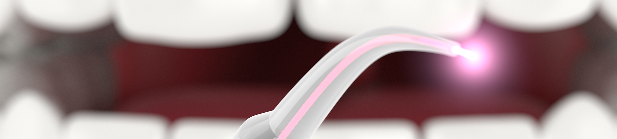 Close up of dental laser