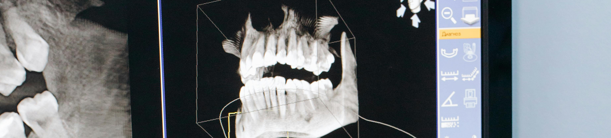 Close up of dental X-rays