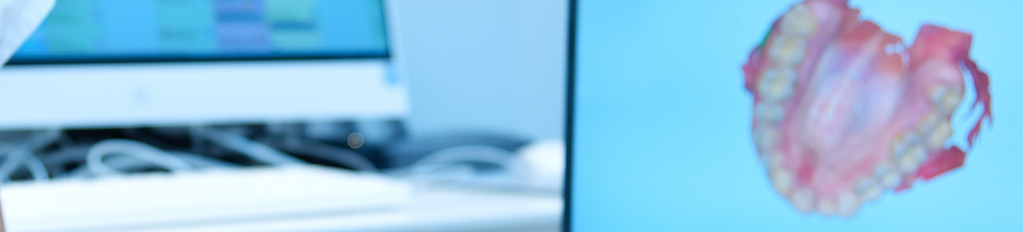 Close up of digital impression of teeth