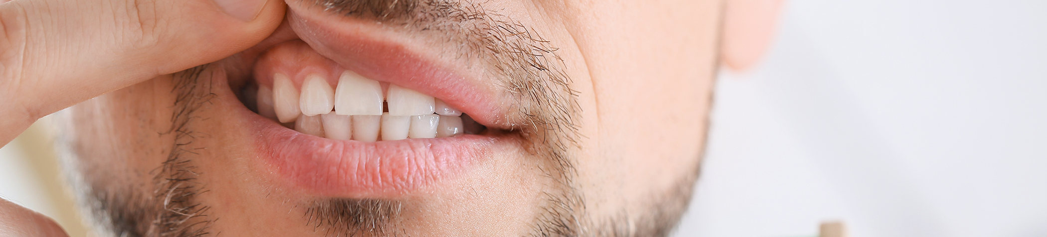 Man pulling up his lip to show gums