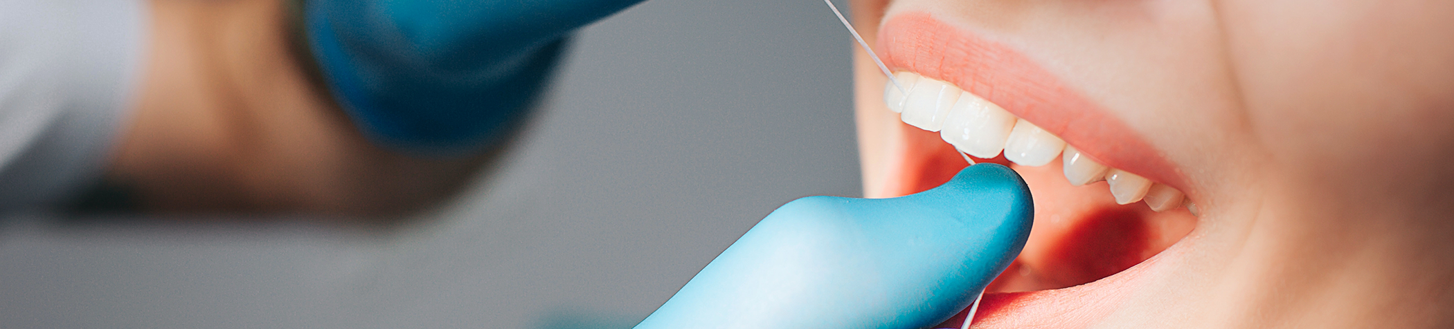 Patient having their teeth flossed