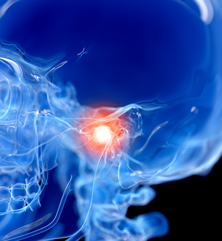 X ray of skull with damaged TMJ highlighted