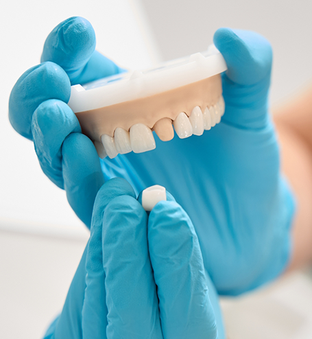 Dental crown sitting on finger